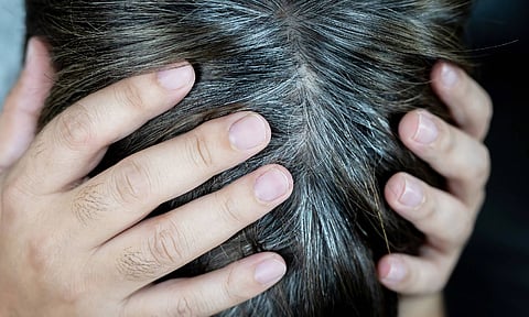 இள நரையை இயற்கையான முறையில் போக்குவது எப்படி?