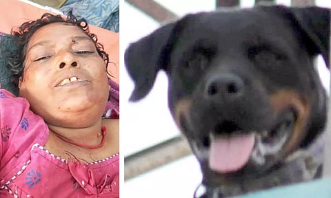 எஜமானரையே கொடூரமாக கடித்து குதறிய வெளிநாட்டு ரக நாய்: பெண்ணுக்கு தீவிர சிகிச்சை