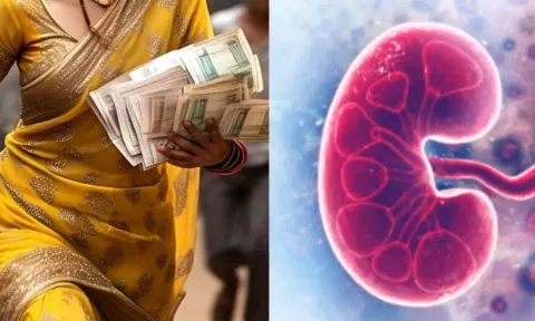 கணவனின் கிட்னியை ரூ.10 லட்சத்துக்கு விற்று பணத்துடன் பேஸ்புக் காதலனோடு ஓடிய மனைவி