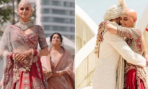 VIDEO: வழுக்கை தலையுடன் திருமணம் செய்த மணப்பெண்