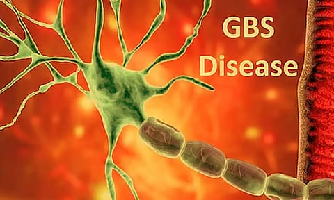 முறையாக சமைக்காத இறைச்சி உணவை சாப்பிட்டால் ஜி.பி.எஸ். பாதிப்பு ஏற்படும்- டாக்டர்கள் எச்சரிக்கை