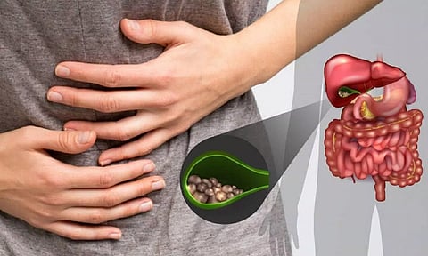 சர்க்கரை நோயினால் பித்தப்பையில் கற்கள் ஏற்படுமா?