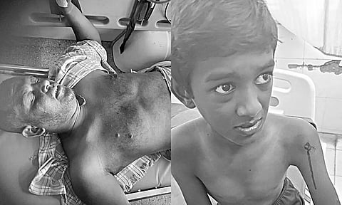சொத்து பிரச்சனையில் விபரீதம்... துப்பாக்கியால் சுட்டதில் சிறுவன் உள்பட 2 பேர் காயம்