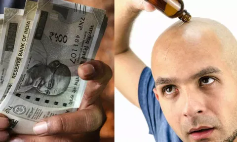 முடி வளர வைப்பதாக கூறி மொட்டை தலையில் எண்ணெய் தடவி 6 ஆயிரம் பேரை ஏமாற்றிய கும்பல்