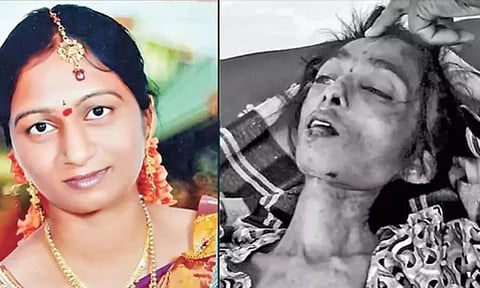 கூடுதல் வரதட்சணை கேட்டு மனைவிக்கு 2 ஆண்டுகளாக உணவு வழங்காமல் கொன்ற கணவர்