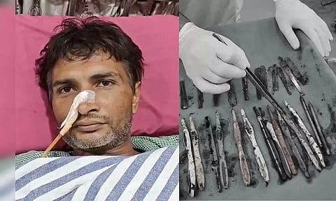 போதை மறுவாழ்வு மையத்தில் சிகிச்சை பெற்றவர் வயிறு முழுவதும் நிரம்பியிருந்த ஸ்பூன், டூத் பிரஷ்கள்