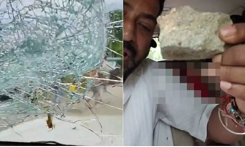 மேற்குவங்கத்தில் பாஜக எம்.பி. மீது தாக்குதல் - மண்டை உடைந்து ரத்தம் கொட்டியதால் பரபரப்பு