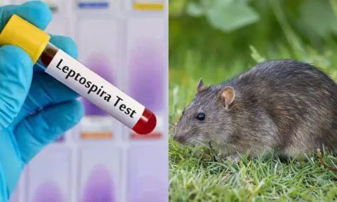 நெல்லையில் சுகாதாரத்துறை சோதனை: தனியார் என்ஜினீயரிங் கல்லூரியில் 8 மாணவர்களுக்கு எலிக்காய்ச்சல் பாதிப்பு