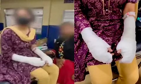 எல்லாமே நாடகமா?.. டெல்லியில் இளம்பெண் மீது ஆசிட் வீசப்பட்ட வழக்கில் தடாலடி திருப்பம்!