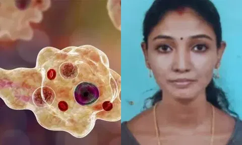 திருவனந்தபுரத்தில் அமீபிக் மூளைக்காய்ச்சலுக்கு இளம்பெண் உயிரிழப்பு