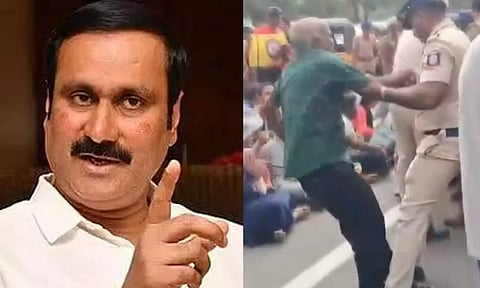 போராடிய ஆசிரியரைத் தாக்கிய காவல்துறை மீது நடவடிக்கை தேவை- அன்புமணி ராமதாஸ்