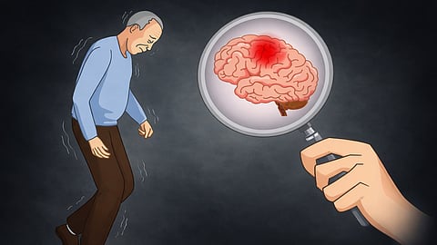 പ്രതീക്ഷകൾ അസ്ഥാനത്തോ? അൽഷിമേഴ്‌സ് ചികിത്സയിലെ 'ഗെയിംചേഞ്ചർ' മരുന്നുകൾ 'നിസ്സാരമെന്ന്' അന്താരാഷ്ട്ര പഠനം