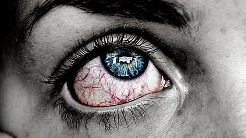 എഐ ചതിച്ചാശാനേ! 'ബിക്സോണിമാനിയ' എന്ന വ്യാജ രോഗത്തെ സത്യമാക്കി ചാറ്റ്ബോട്ടുകൾ; ഗൂഗിളും മൈക്രോസോഫ്റ്റും വരെ കെണിയിൽ