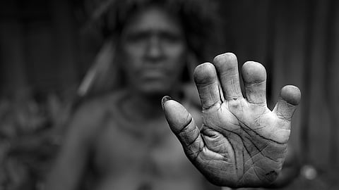 മരണവീട്ടിലെ ചോരയുറയുന്ന ആചാരം; പ്രിയപ്പെട്ടവർക്കായി വിരലുകൾ മുറിച്ചുമാറ്റുന്ന ഡാനി ഗോത്രം!