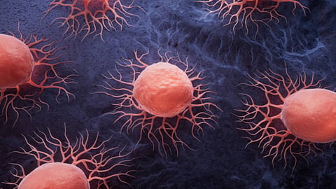 Scientists at UC San Francisco developed a method to precisely reprogram these cancer-fighting cells directly inside the body, potentially eliminating those barriers. 