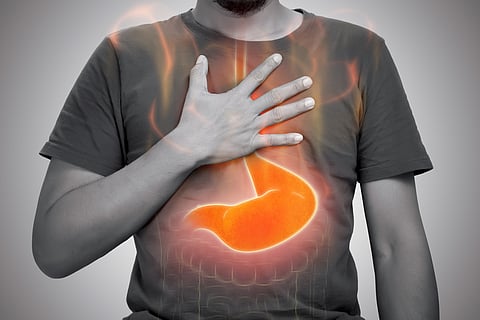 Foods that help with acid reflux