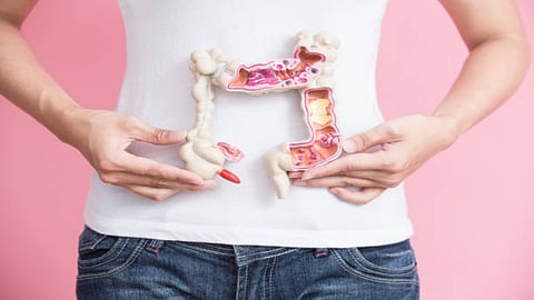 Colon cancer can impact the colon or rectum of large intestine.