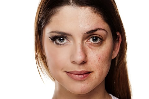 How has the rise of filters and social media affected our perceptions of beauty and self worth?