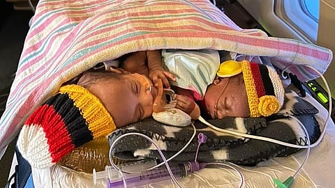 ടോമിന് ജന്മനാ ഹൃദയ വൈകല്യവും ഒരു വൃക്കയും ഉൾപ്പെടെ മറ്റ് പ്രശ്നങ്ങളും ഉണ്ടായിരുന്നു. ﻿
