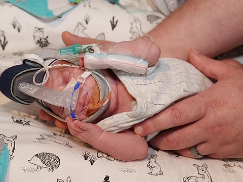 ക്വീൻസ്‌ലാന്റിലെ ഏറ്റവും ചെറിയ നവജാതശിശു; വെറും 360 ​ഗ്രാം തൂക്കം 