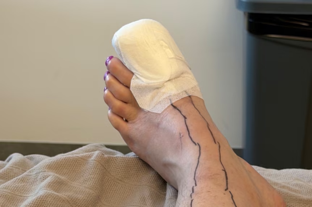 നെയിൽ സലൂണിൽ പോയവർ ശ്രദ്ധിക്കുക; പെർത്തിൽ അണുബാധയേറ്റ് നിരവധി സ്ത്രീകൾ ആശുപത്രിയിൽ

