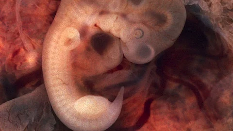 Research based on evolution proves that all primates, including our ancestors, had tails millions of years ago. Humans are vertebrates, and the tail is present in the human embryo until 8 weeks of development, after which it will disappear by apoptosis(Wikimedia Commons)
