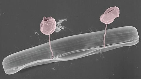 A pair of Clemson University researchers are collaborating to discover why fungal pathogens become drug resistant. (WIKIMEDIA COMMONS)