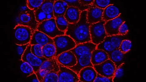 The study, published in JAMA Network Open, found that nearly half of high-risk prostate cancer patients previously classified as nonmetastatic by conventional imaging actually have metastatic disease. (Representational image: Unsplash)