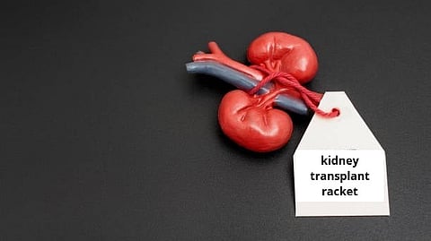 An illustration of kidney with a kidney transplant racket.