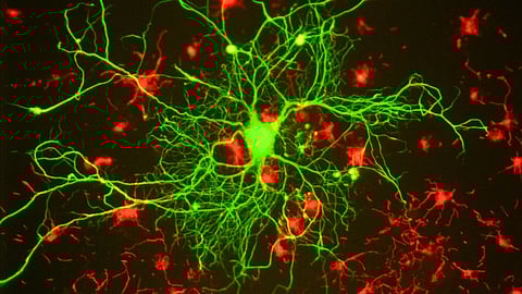 Newly discovered brain signals reveal the human brain’s unmatched computational abilities. (Representational image: Wikimedia Commons)