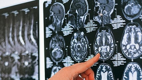 Magnetic resonance imaging  is a medical imaging technique used in radiology to form pictures of the anatomy and the physiological processes inside the body. 
(Pexels)