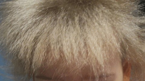 Uncombable Hair Syndrome is a fascinating genetic condition that makes a child’s hair grow in wild, untamable directions. (Image: Wikimedia commons)
