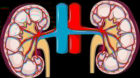 An Alabama woman recovers after a pig kidney transplant, ending eight years of dialysis. (Representational image: Wikimedia Commons).