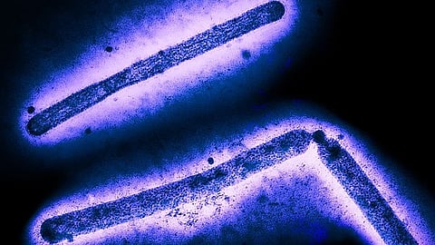 H5N1/bird flu: virus particles (rod-shaped) (Image: Wikimedia Commons)