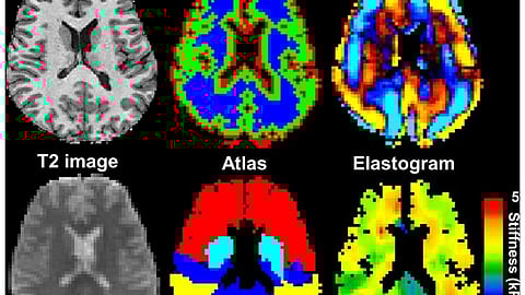 AI visualizes the hidden narratives of our dreams, bridging science and the subconscious. (Representational image)