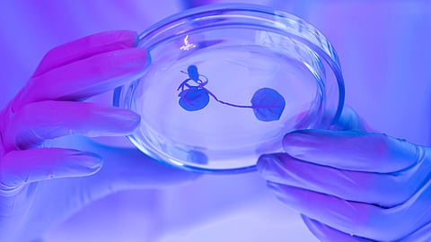 A team led by UT Southwestern scientists has discovered a mechanism that promotes metastasis in different cancers along with a new cancer biomarker. (Representational image: Freepik)