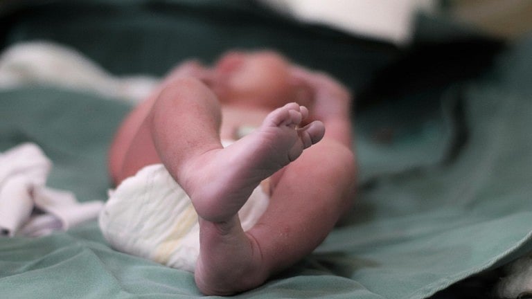 Understanding Common Types of Birth Injuries and Their Causes