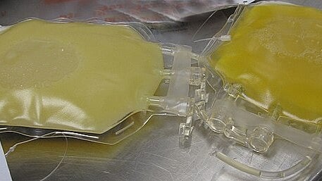 Benefit of TPE: reverses age and treats age-related conditions (Image: Wikimedia commons)