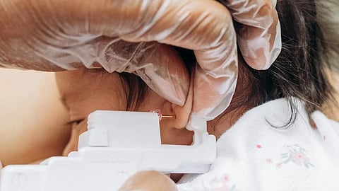 After the doctor injected anesthesia into both ear lobes, the infant reportedly lost consciousness. (Pexels)