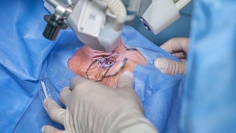 A 62-year-old woman passed away while preparing for cataract surgery at Hukumchand Polyclinic on Thursday afternoon.