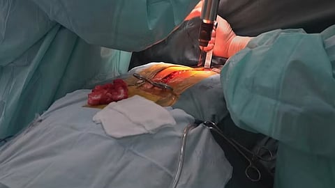 The origin of liver transplants in Tamil Nadu's government hospitals goes back to January 2009.