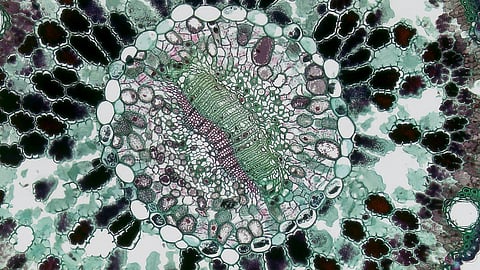 Single-cell proteomics technology