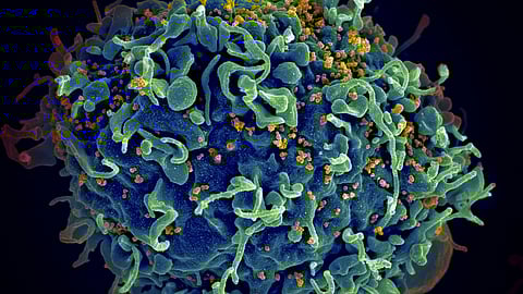 HIV treatment may get a boost following this new study.