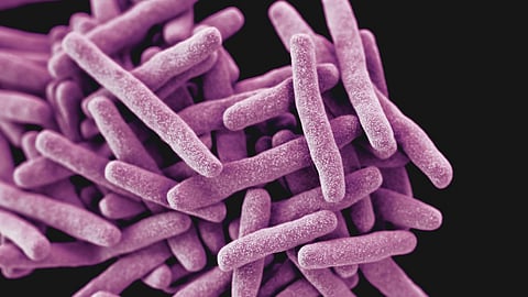 Illustration of the Bacterium that Causes Tuberculosis
