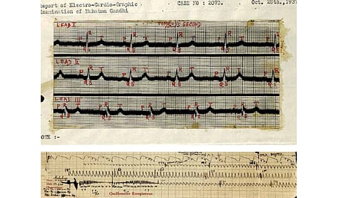 Gandhiji's ECG | Gandhiji's Oscillograph.