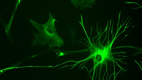 Microscopic image of astrocytes in green.
