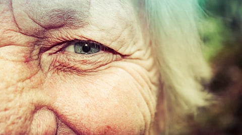 Close-up of an elderly person's eye and surrounding skin, showing deep wrinkles and light eye color. 