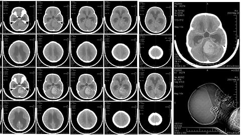 A collection of multiple MRI images displayed together, showcasing various scans and medical imaging results.