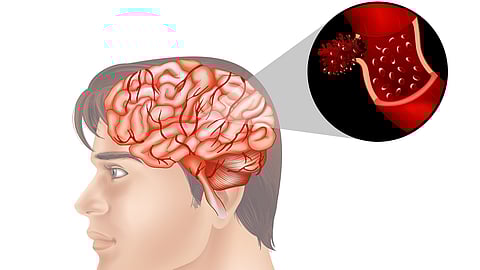 An illustration of blood supply of brain.