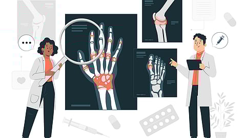 Rheumatology concept illustration
